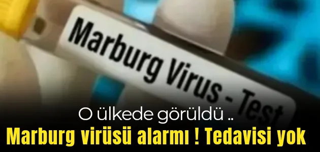 Ülkede ölümcül Marburg virüsü alarmı! Tedavisi yok