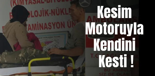 Kesim motoru ile kendini kesti !