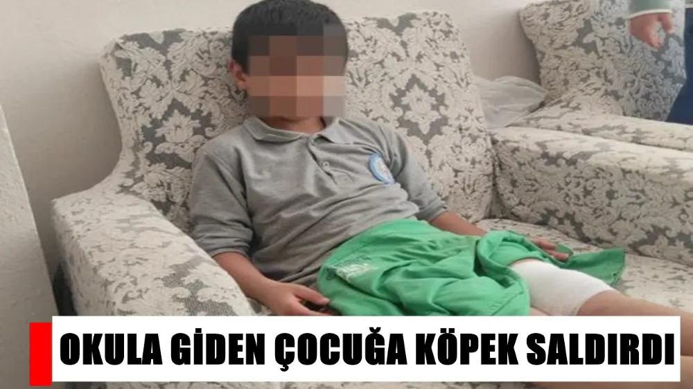 KÖPEK DEHŞETİ: 8 YAŞINDAKİ ÇOCUĞA SALDIRDI