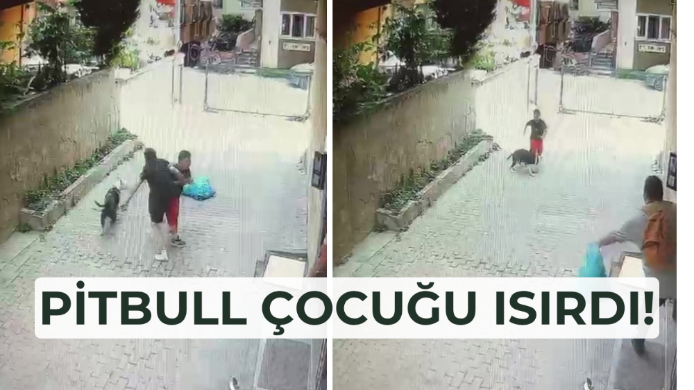Pitbul çocuğa saldırdı!