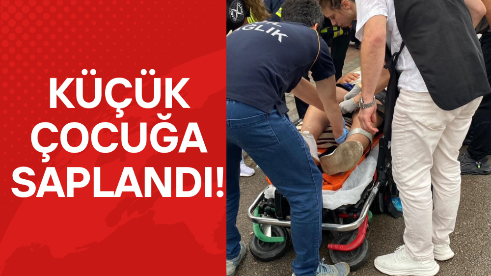 Bisikletten düşen çocuğun bacağına direksiyon saplandı