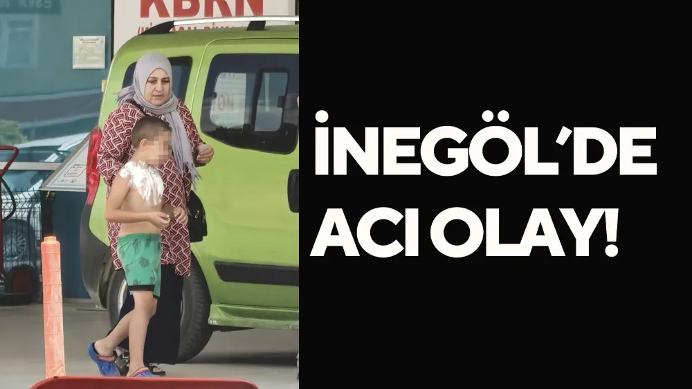 Üzerine parfüm sıkıp çakmak yakan çocuk yaralandı