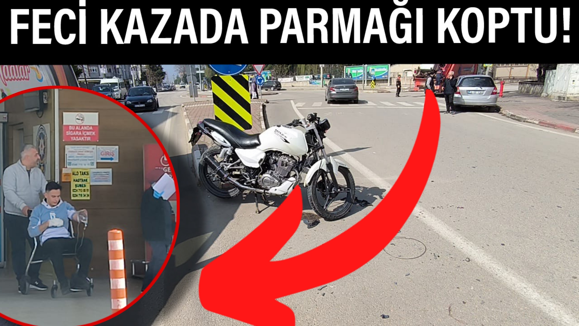 Feci kazada parmağı koptu!